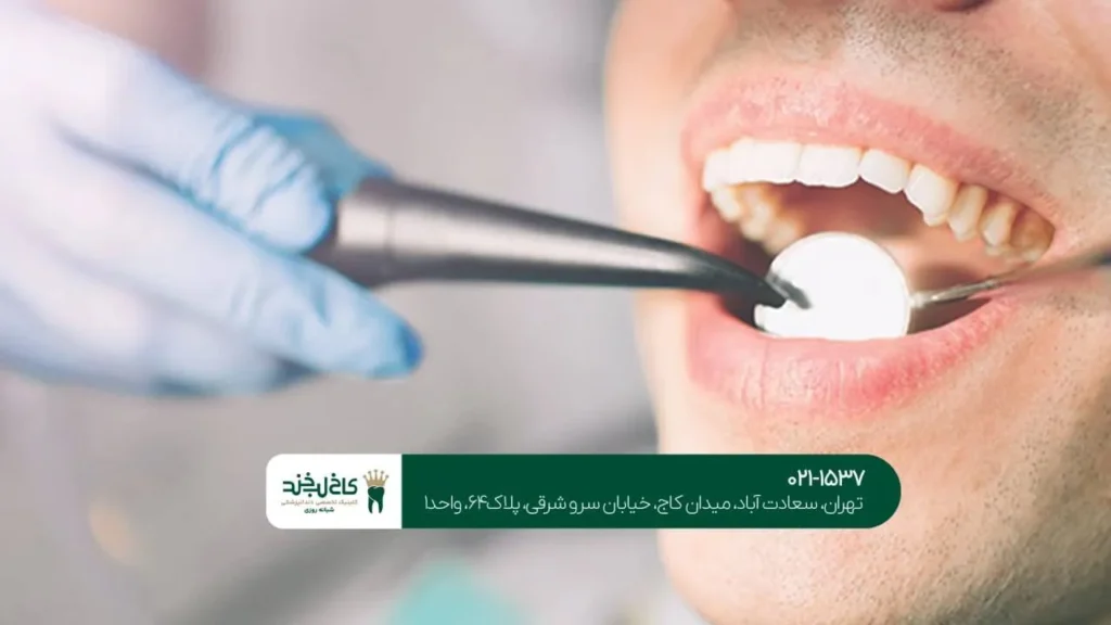 کلینیک دندانپزشکی زیبایی در تهران